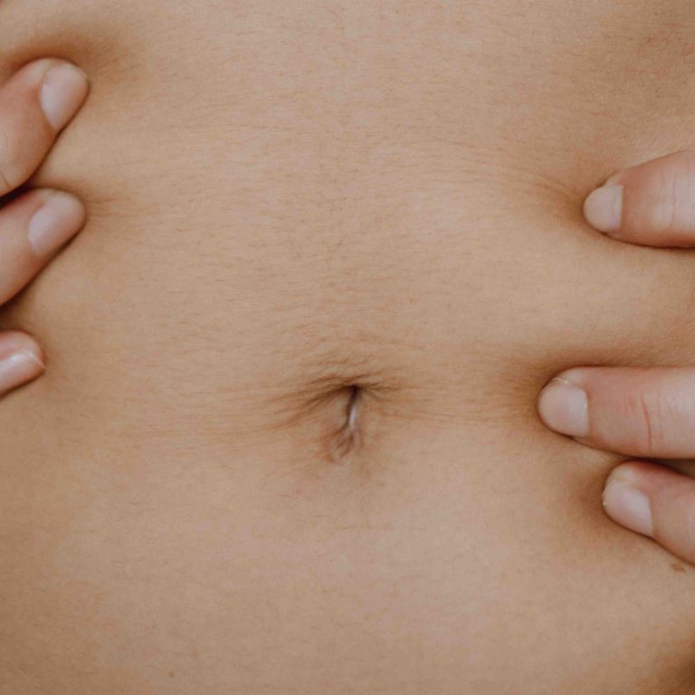 Tummy Tuck Surgery Pricing in Northern Virginia