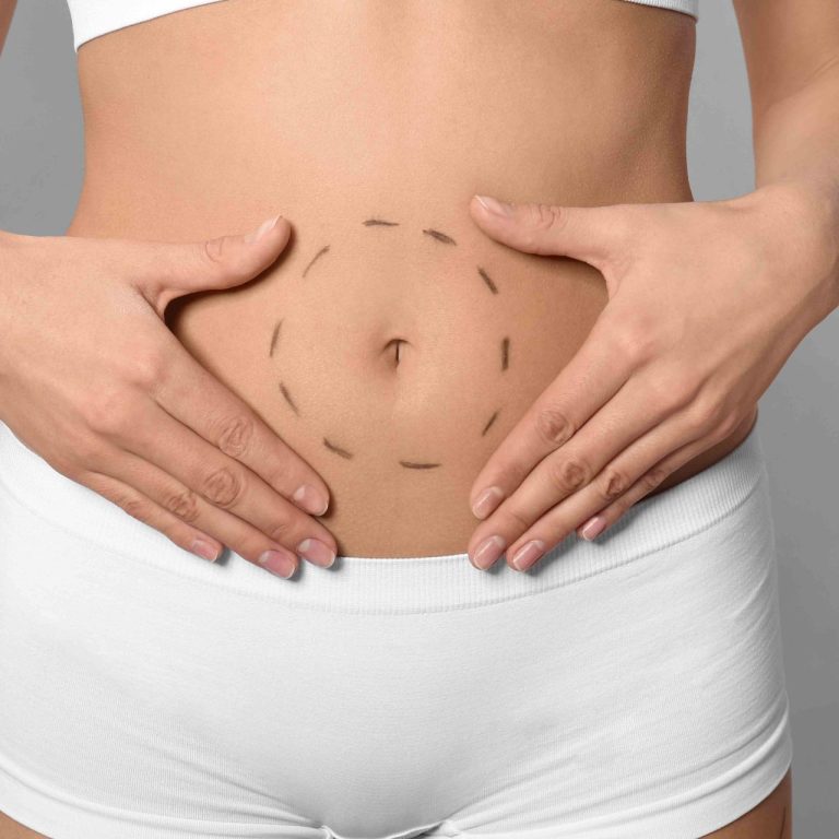 Mini vs. Full Tummy Tuck Pricing in Falls Church Virginia