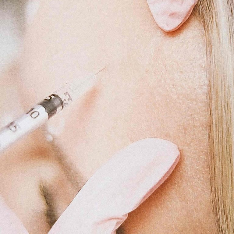 Botox Appointment for Forehead Lines in Vienna Virginia