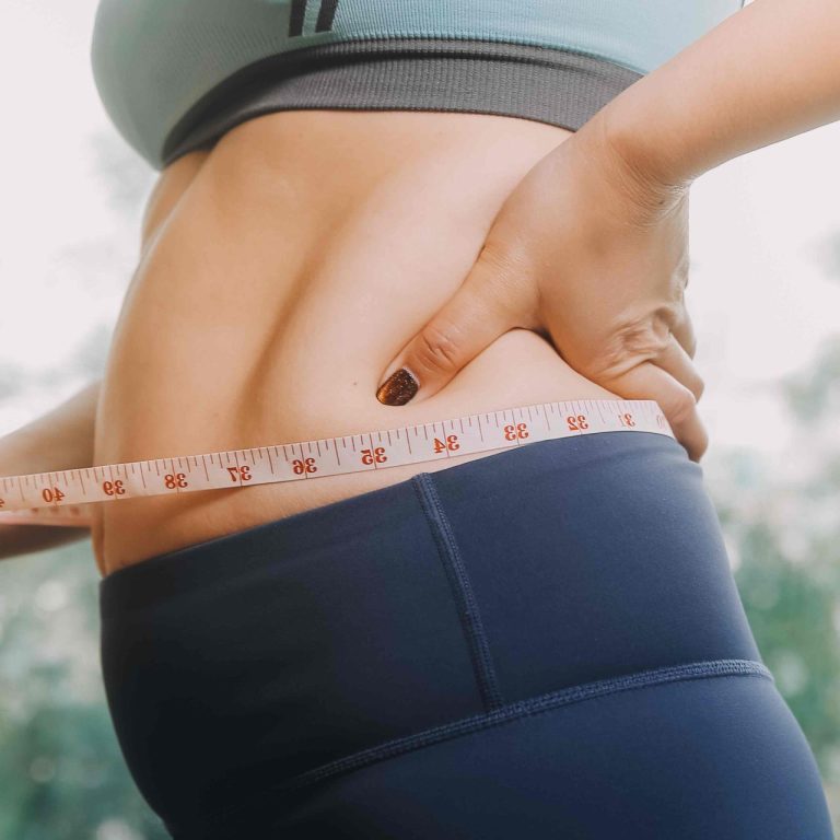 Liposuction Before-and-After Results in McLean Virginia
