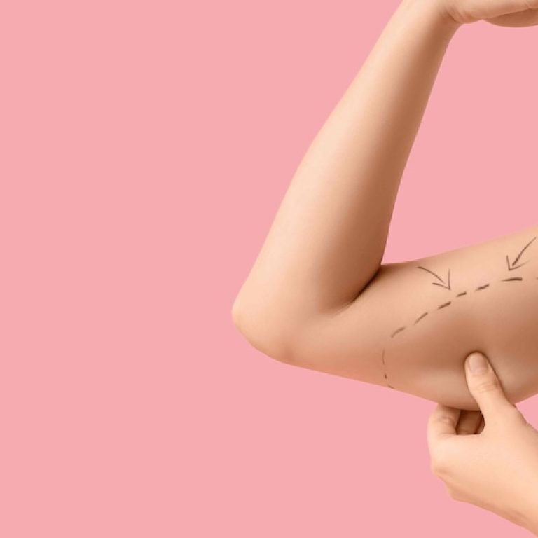 Liposuction Savings Tips in Northern Virginia