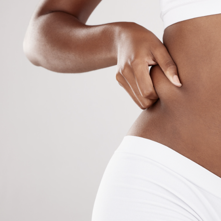 Liposuction Specialists in Northern Virginia