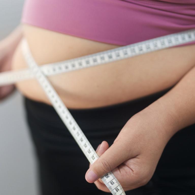Tummy Tuck Cost in Arlington