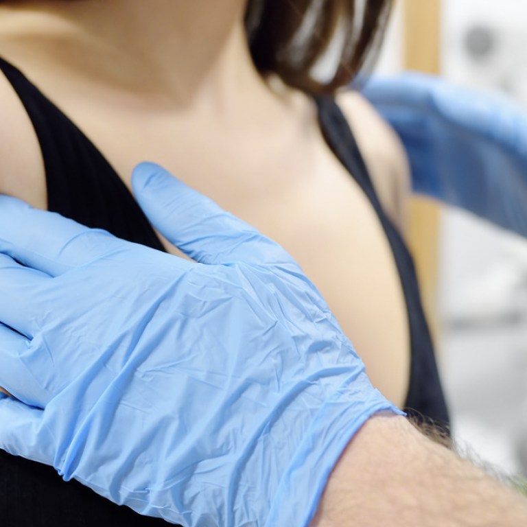 Tysons Corner's Top Breast Reduction Surgeon