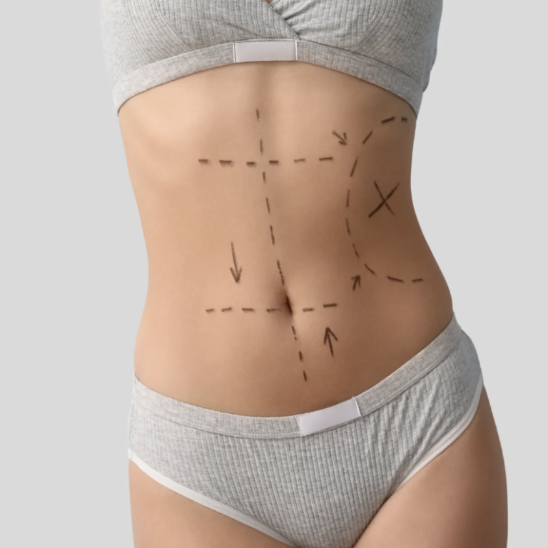 Cost-Effective Abdominoplasty Solutions Near Alexandria VA