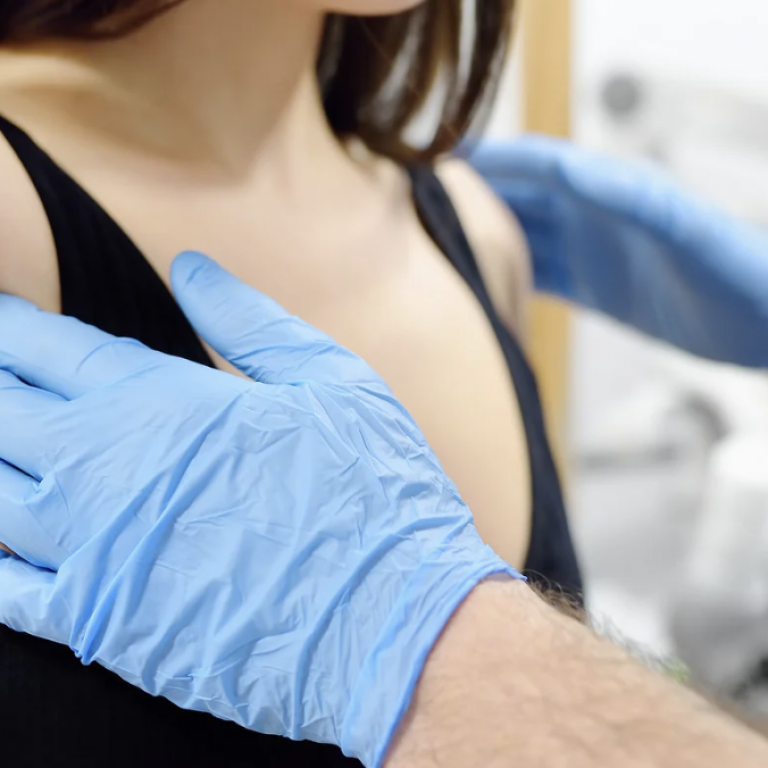 Breast Reduction Costs in Reston Herndon and Vienna
