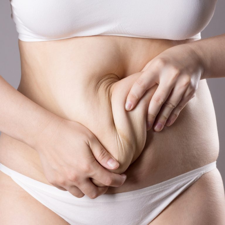 Your Guide to the Best Tummy Tuck Cost in Fairfax