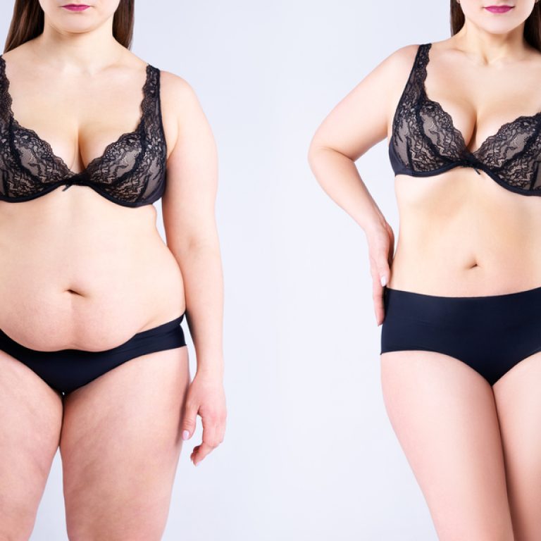 Want the Best Liposuction Results in Fairfax Virginia