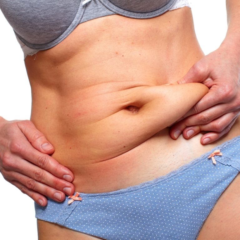 How Much Does a Tummy Tuck Cost in McLean, Virginia?