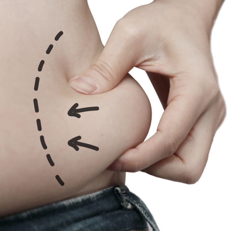 Choosing a Liposuction Specialist in DC: 5 Tips to Find the Best!